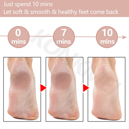UrbanVibe™ Electric Foot Dead Skin Remover