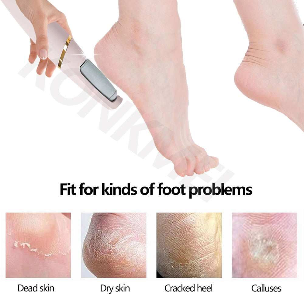 UrbanVibe™ Electric Foot Dead Skin Remover